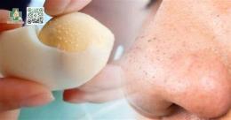 ảnh chụp màn hình cách làm trắng da trị mụn bằng trứng gà