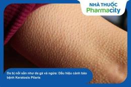 ảnh chụp màn hình da bé sần như da gà