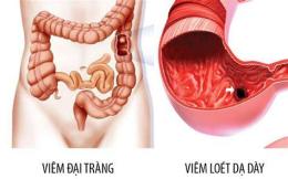 ảnh chụp màn hình đau dạ dày có ăn được trứng gà luộc không