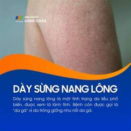 ảnh chụp màn hình dày sừng nang lông (da gà)