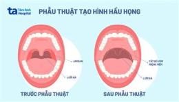 ảnh chụp màn hình gà đá về bị sưng hầu
