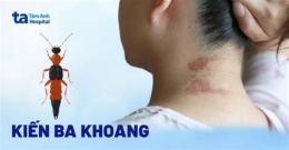 ảnh chụp màn hình kiến ba khoang gây phỏng da