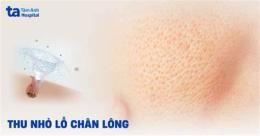 ảnh chụp màn hình lỗ chân lông nổi như da gà