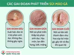 ảnh chụp màn hình sùi mào gà da