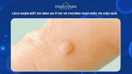 ảnh chụp màn hình sùi mào gà ở da tay