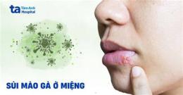 ảnh chụp màn hình sui mao ga o da