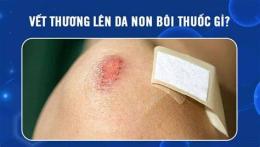ảnh chụp màn hình vết thương lên da non ăn gà được không