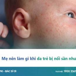 bé bị nổi da gà
