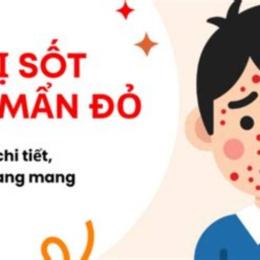 bé sốt mà nổi da gà