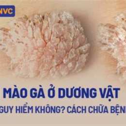 bệnh da gà ở tay