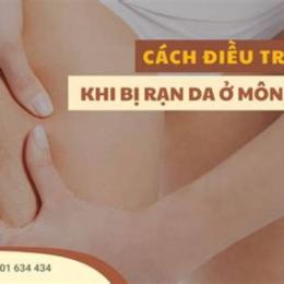 cách trị mông da gà
