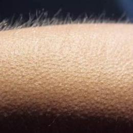 con người khi lạnh có nổi da gà ko