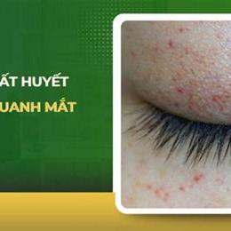 da huyet ga