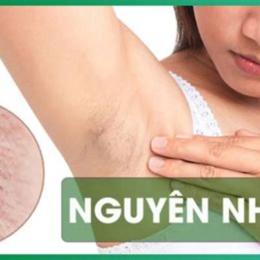 da nách như da gà