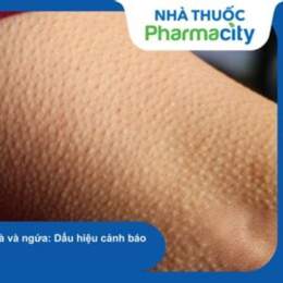 da sần như nổi da gà
