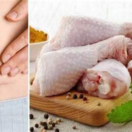 đẻ mổ có được ăn da gà không