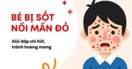 giao diện app bé sốt nổi da gà có sao không