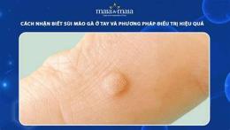 giao diện app bệnh da gà ở tay