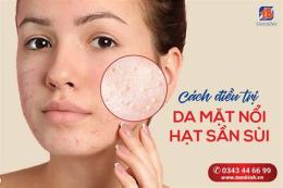 giao diện app da mặt bị nổi sần như da gà