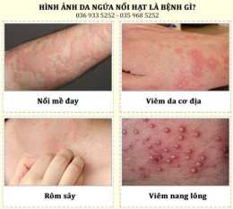 giao diện app da ngua noi nhu da ga