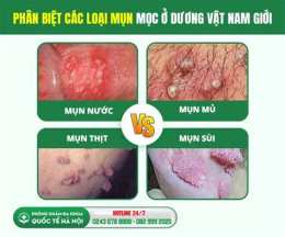 giao diện app dương vật nổi mụn như da gà