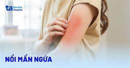 giao diện app mẩn ngứa nổi da gà