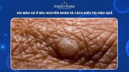 giao diện app sùi mào gà da bìu