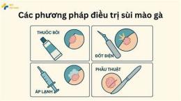 hướng dẫn sử dụng điều trị sùi mào gà tại đà nẵng