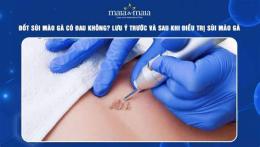 hướng dẫn sử dụng đốt sùi mào gà ở bệnh viện da liễu webtretho