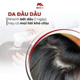 hướng dẫn sử dụng gàu da đầu nhẹ