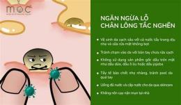 hướng dẫn sử dụng lỗ chân lông nổi như da gà