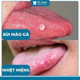 hướng dẫn sử dụng nguyên nhân dẫn đến sự đa dạng mào ở gà