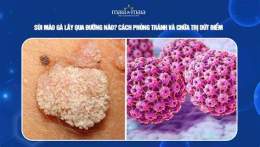 hướng dẫn sử dụng sùi mào gà lây qua da