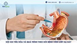 hướng dẫn sử dụng tại sao trong dạ dày gà lại có sỏi
