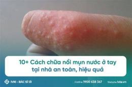 hướng dẫn sử dụng tay nổi da gà ngứa