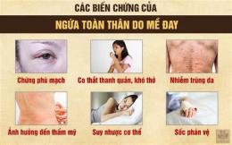 hướng dẫn sử dụng triệu chứng ớn lạnh nổi da gà