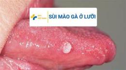 hướng dẫn sử dụng xét nghiệm sùi mào gà ở đâu đà nẵng