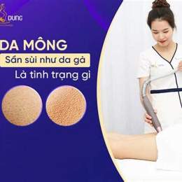 mông da gà