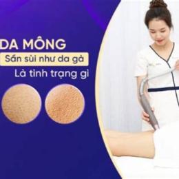 mông sần da gà