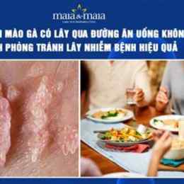 sùi mào gà có lây qua tiếp xúc da không
