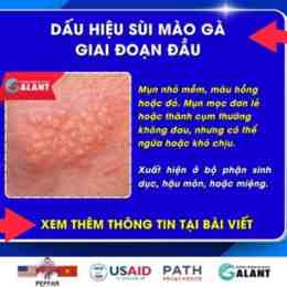 sui mao ga o da
