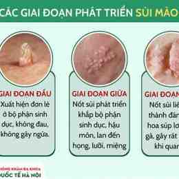 thay troi da sang ga gay o o
