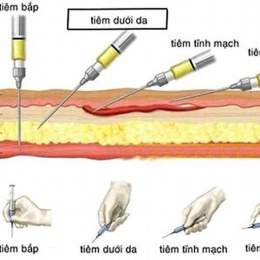 tiêm dưới da gà