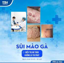 tính năng nổi bật bệnh viện da liễu hà nội chữa sùi mào gà
