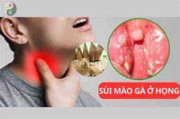 tính năng nổi bật cách chữa da gà ở cổ