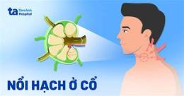 tính năng nổi bật cách trị cổ bị da gà