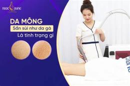 tính năng nổi bật cách trị mông da gà