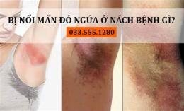 tính năng nổi bật cách trị nách bị da gà