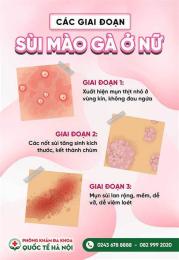 tính năng nổi bật chữa bệnh sùi mào gà ở đà nẵng