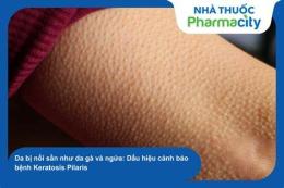 tính năng nổi bật da bị sần như nổi da gà